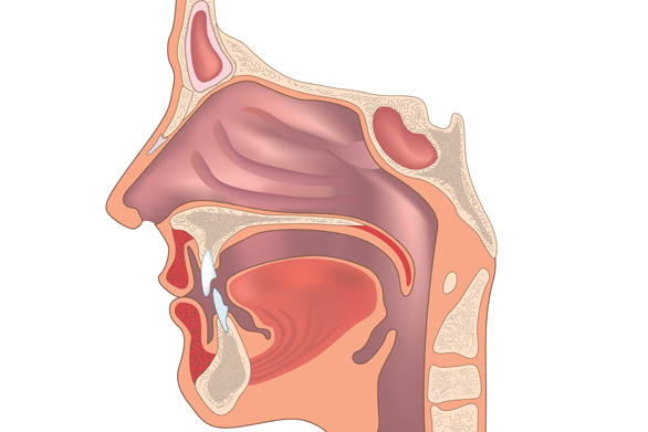 Septoplastyka (operacja przegrody nosa)