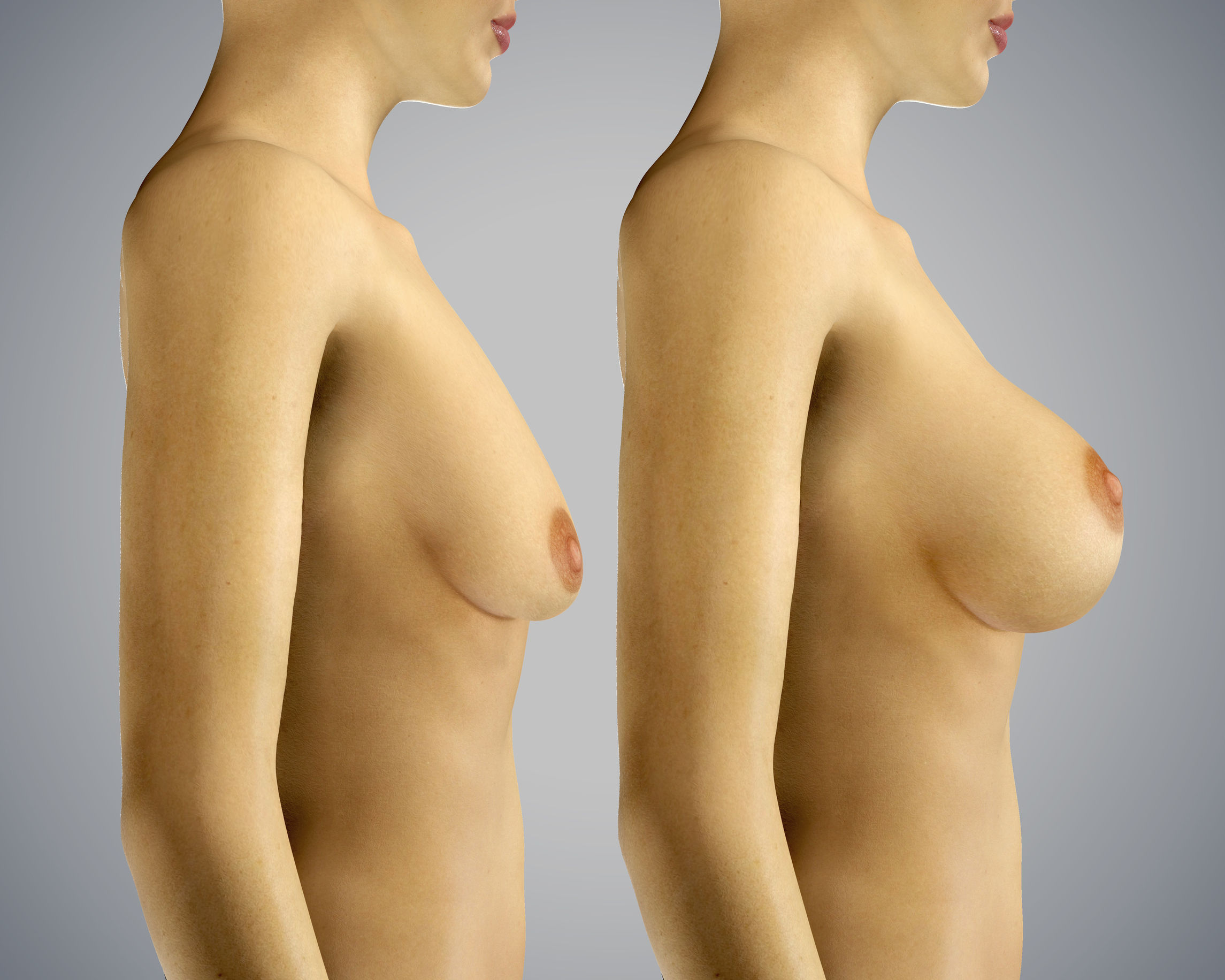 Powiększenie piersi własną tkanką tłuszczową
